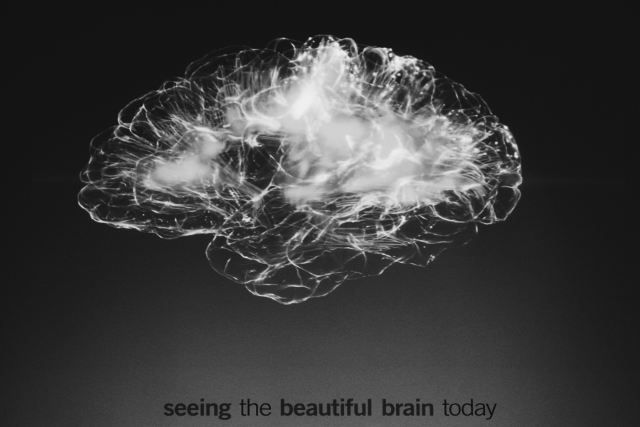 imagem de um cérebro representado em luzes